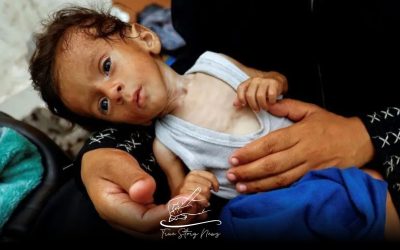 Starving Gaza children are too weak to cry, according to an NGO