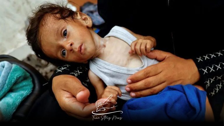 Starving Gaza children are too weak to cry, according to an NGO